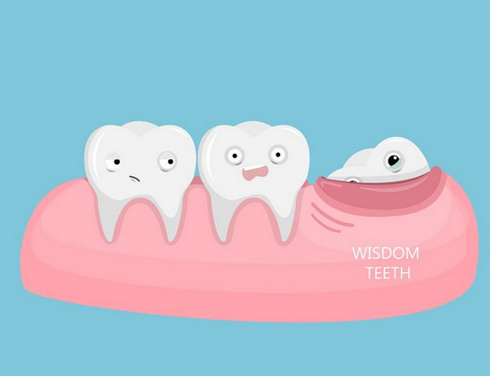 Чи треба видаляти зуби мудрості: стоматолог розкрив "секрет"